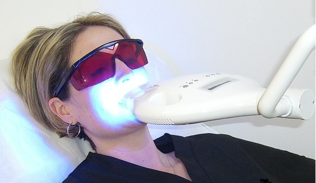 Tooth Whitening Systems